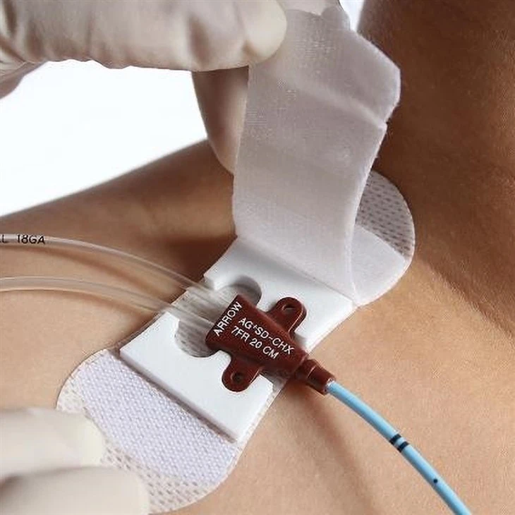 Catheter Fixation Device