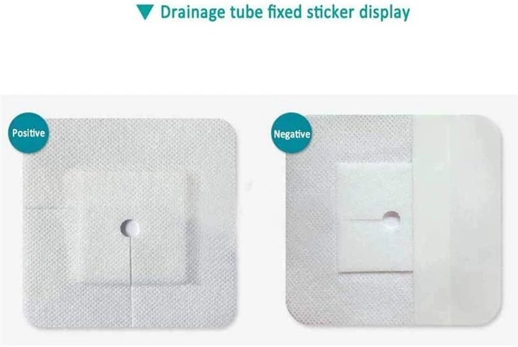 Split Nonwoven Island Dressing